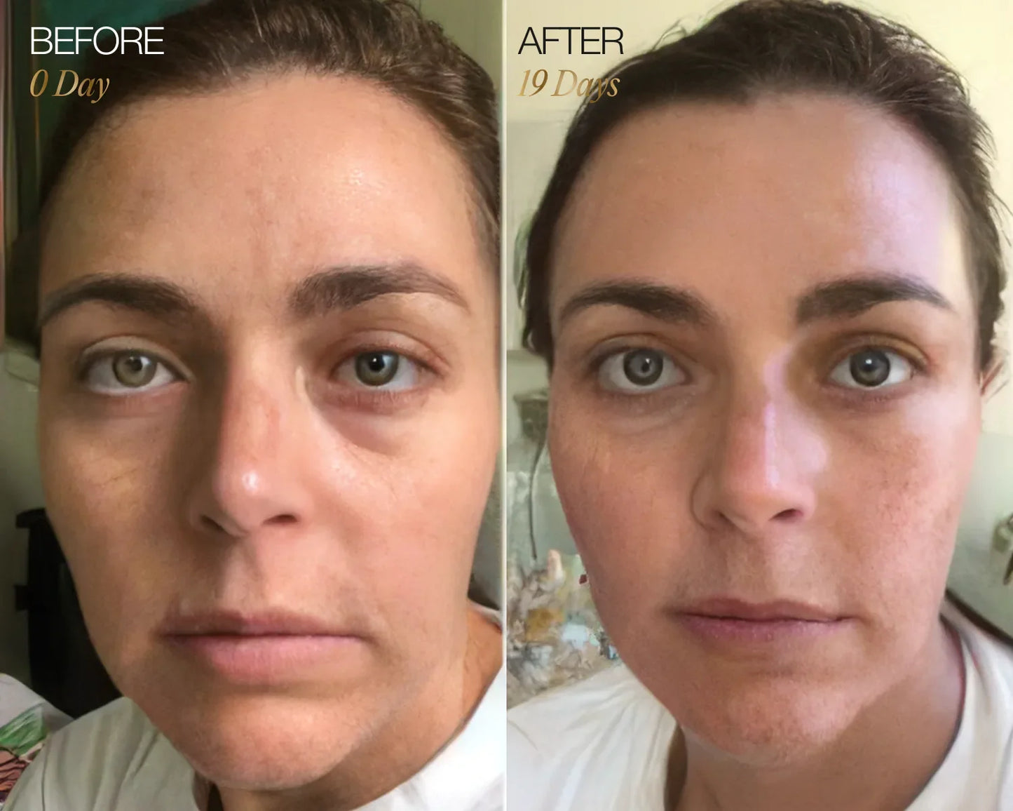 RadiantGlow Facial Brush