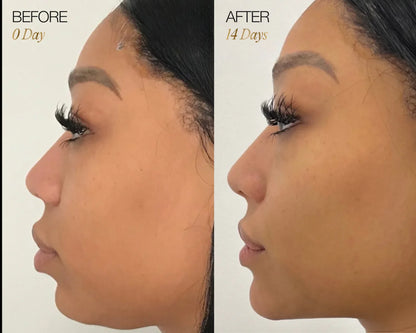 RadiantGlow Facial Brush