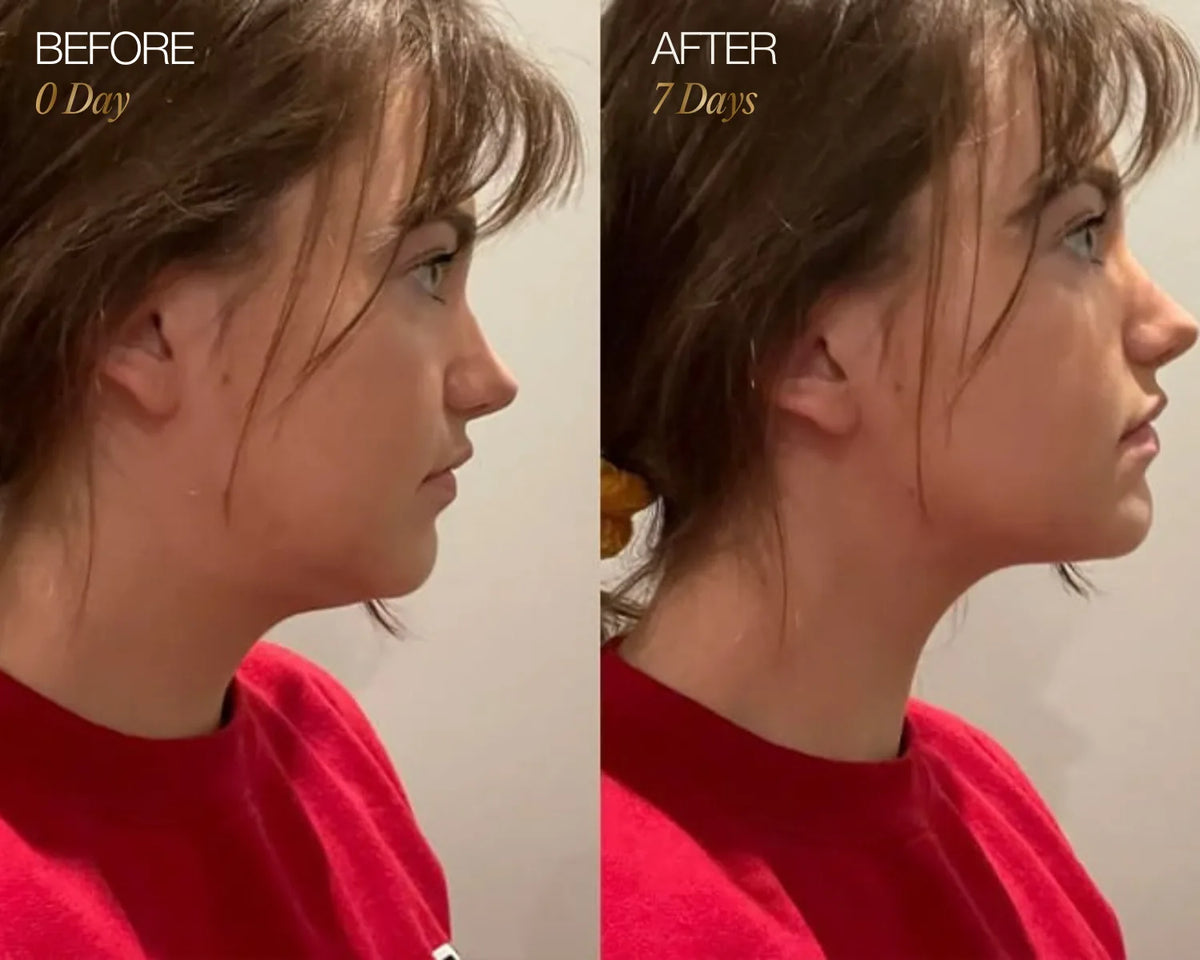 RadiantGlow Facial Brush