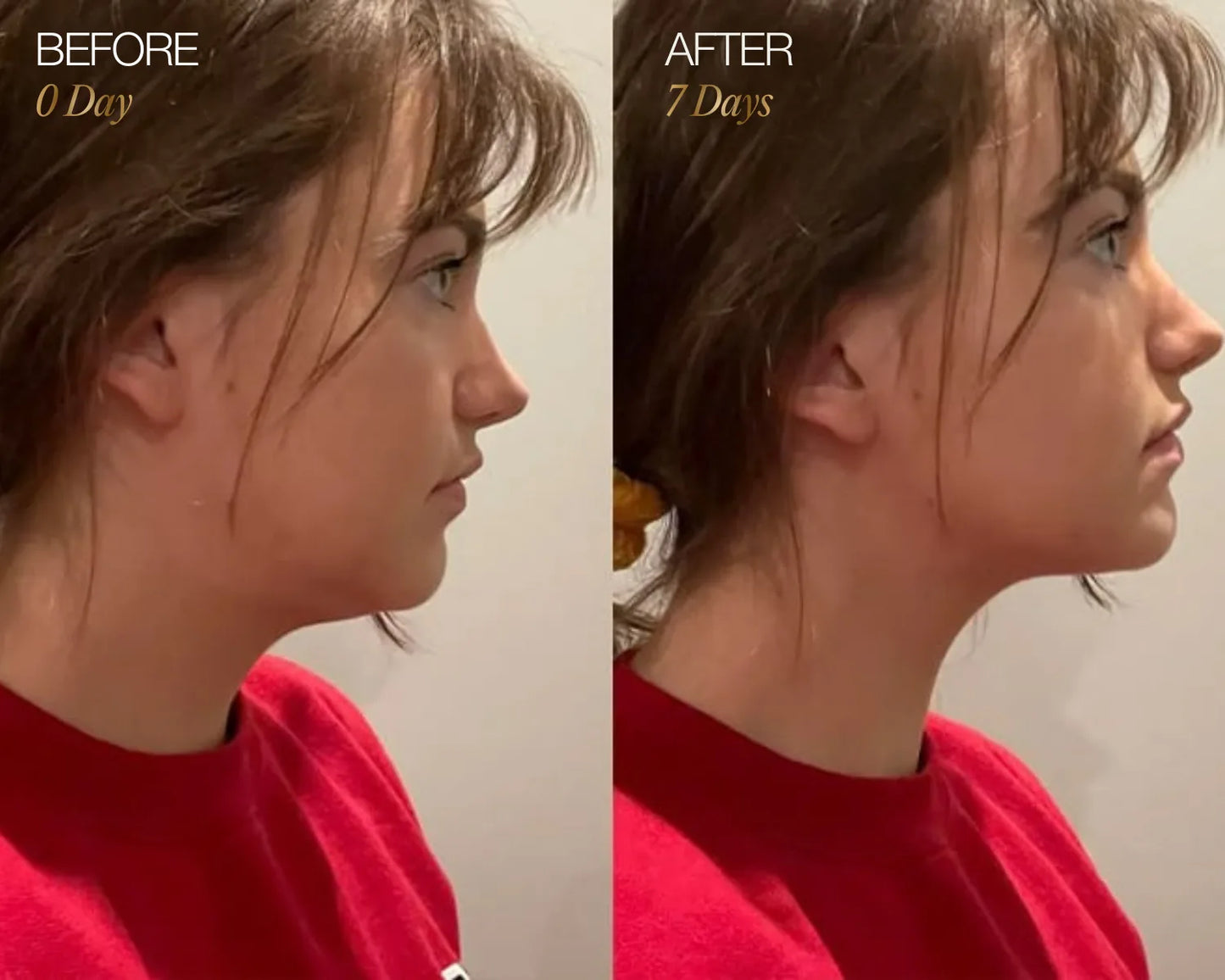 RadiantGlow Facial Brush