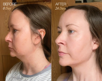 RadiantGlow Facial Brush