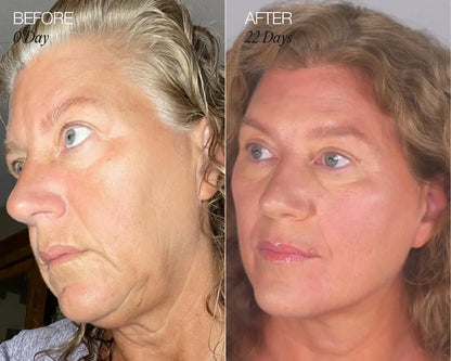 RadiantGlow Facial Brush