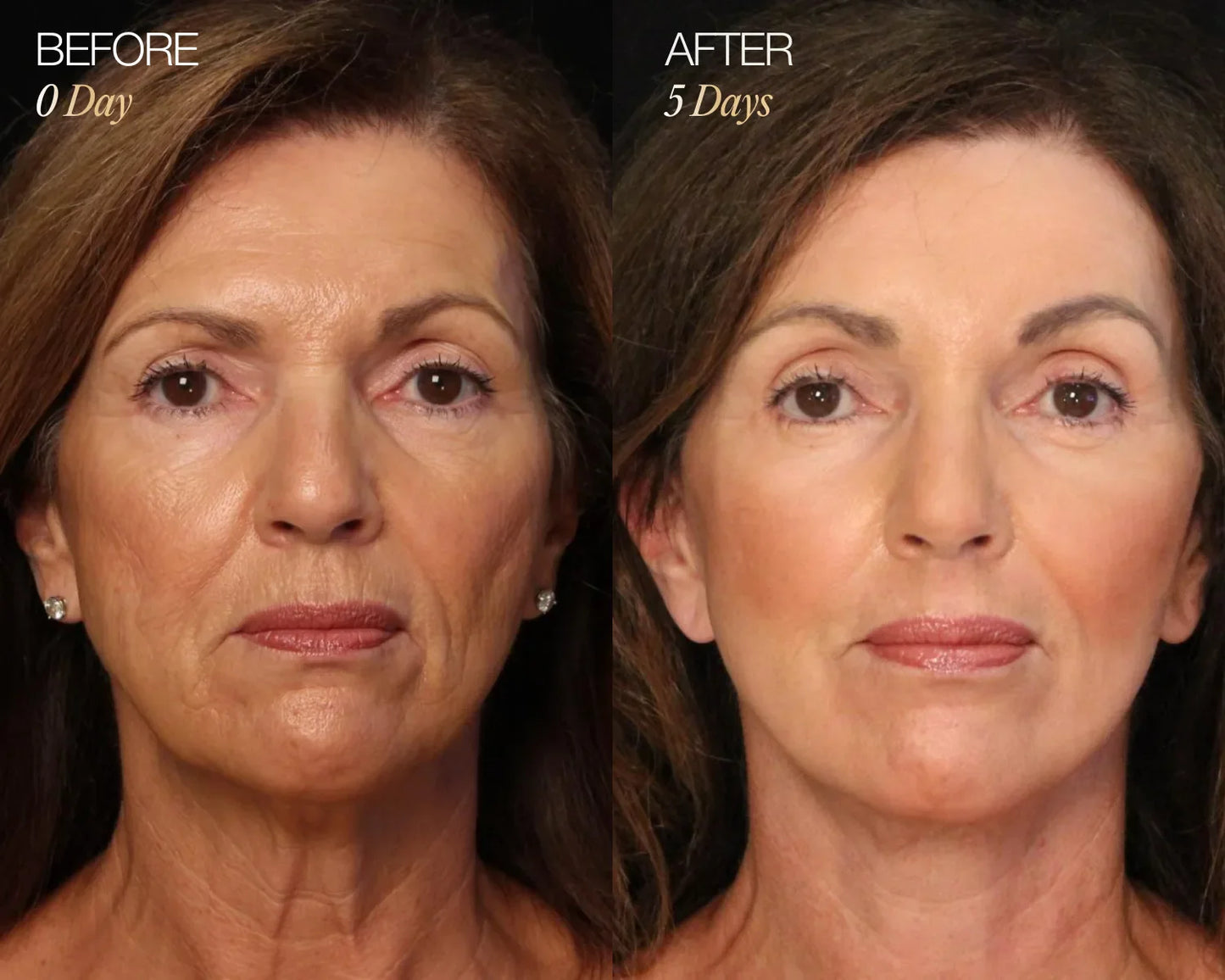 RadiantGlow Facial Brush